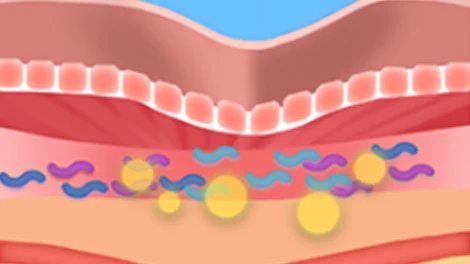 Skin section with a shallow central depression, blue and purple fibres and highlighted yellow circles.