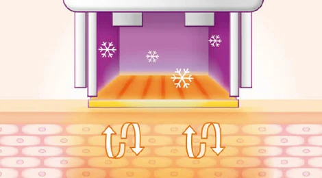 治療探頭示意圖,同時呈現有色能量區、雪花與彎曲箭頭。