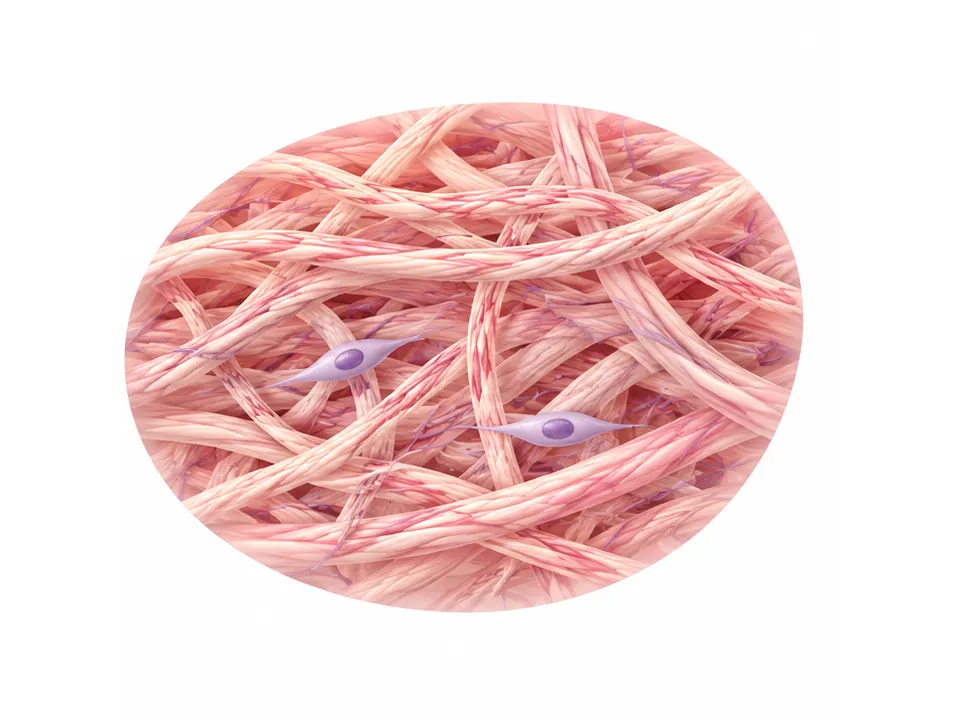 Magnified illustrated dermal fibers crossing around spindle-shaped cells.